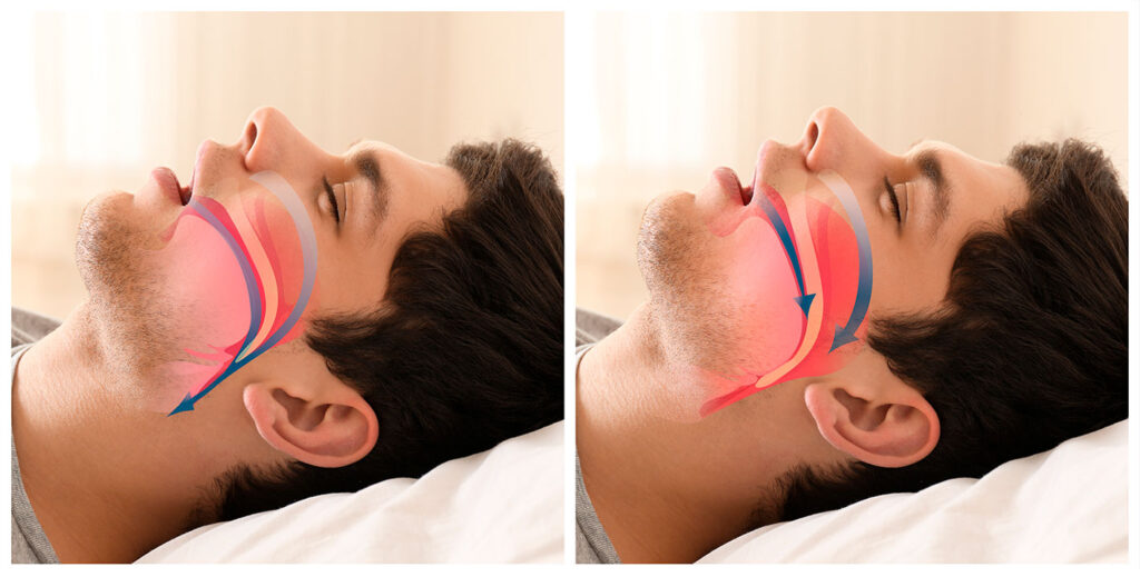 russare-visuale-grafica